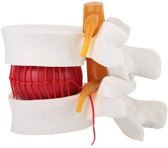 1.5 - Modello Anatomico - Modello in Plastica - Modello di Dimostrazione - Colonna Vertebrale Lumbare - Disco Intervertebrale Molle - Modello Anatomico