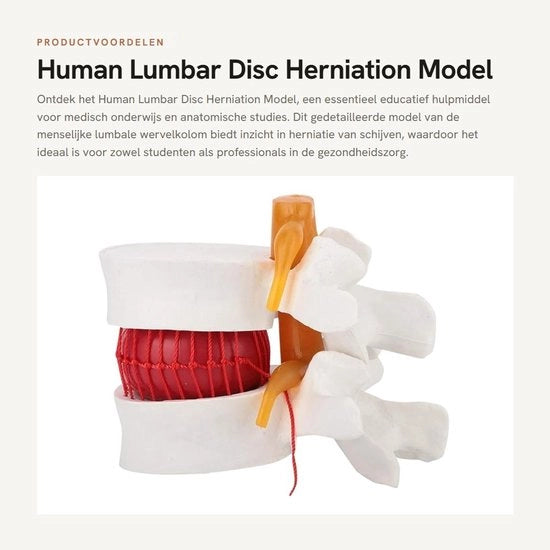 Modello di Anatomia della Colonna Vertebrale Lombare - Modello 1:1.5 - Colonna Vertebrale con Disco Interspinale morbido - Modello di Demonstrazione in Plastica - Modello Anatomico