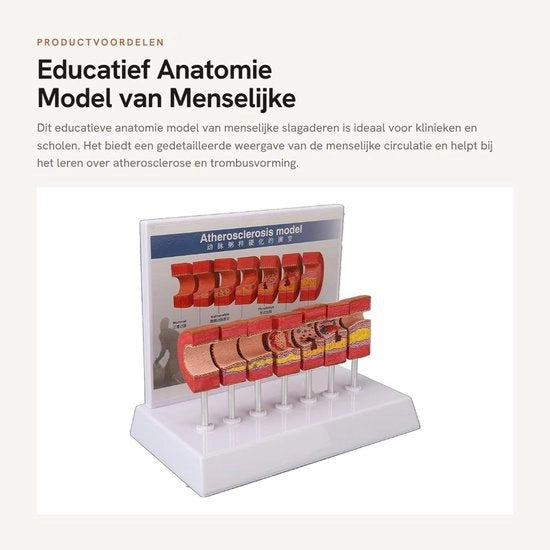 Modello Anatomico Educativo in PVC - 7 Pezzi - Comunicazione Arts/Paziente - Sicuro e Affidabile - Modello Anatomo-educativo